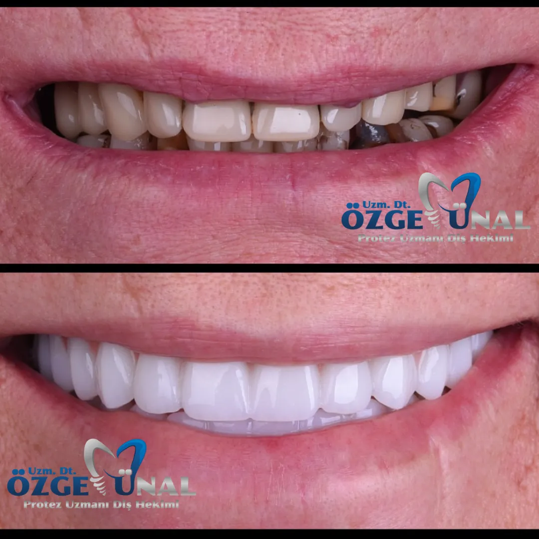 Uzm. Dt. Özge Ünal Karagöz - klinik ve hasta fotoğrafı